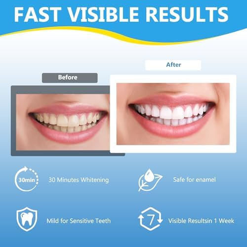 Teeth Whitening Strips for Sensitive, 42 Strips Whitener Safe Whitestrip, Deep Stains Removal Tooth Whitening, Enamel Safe Non-Slip Dry Strip Technology for Whiter Teeth, Mint
