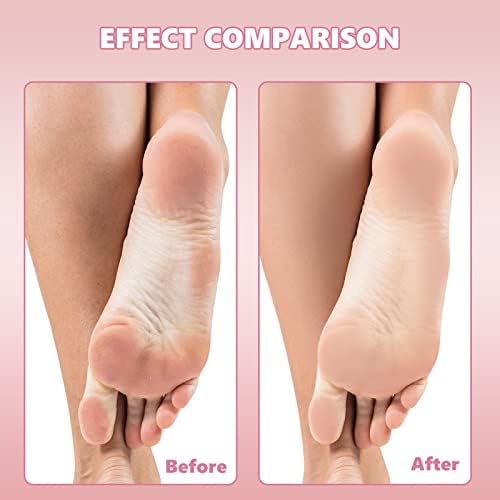 Flutesan 80 Pcs Stainless Steel Foot File Refills Foot File Replacement Pads Coarse Fine Pedicure File Refills Double Side Reusable Foot Rasp Pad with Removable Glue, 180 Grit, 120 Grit (Black)