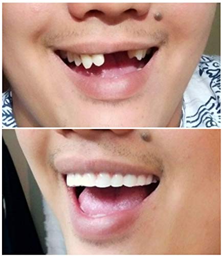 Instant Smile Comfort Fit Flex Natural Shade