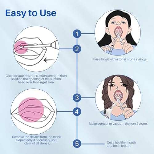 Upgraded Tonsil Stone Remover Tool with Silicone & Glass Probes, 11 in 1 Rechargeable Electronic Tonsil Stone Vacuum with Built-in LED Light, Fight Bad Breath Instant Suction