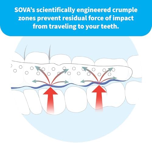 SOVA Aero Night Guard with Case - 1.6mm Thin - Custom-Molded Fit - Protects Against Nighttime Teeth Grinding & Clenching - FSA/HSA Eligible - Odor & Taste Free - Remoldable Up to 20 Times - Non Toxic