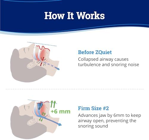 ZQuiet, Anti-Snoring Mouthpiece, Firm Size #2, Strong & Durable Mouthguard, Ideal for Those Prone to Teeth Grinding & Clenching, Made in USA, Size 2