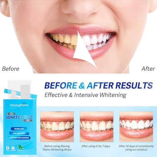 Waving Palms Teeth whitening Strips for Tooth White: Professional Dental Teeth whitening Strips - 28 whitening Strips- White Strips for Teeth whitening for The Perfect Smile, Blue
